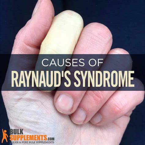 Raynaud’s Syndrome: Symptoms, Causes & Treatment